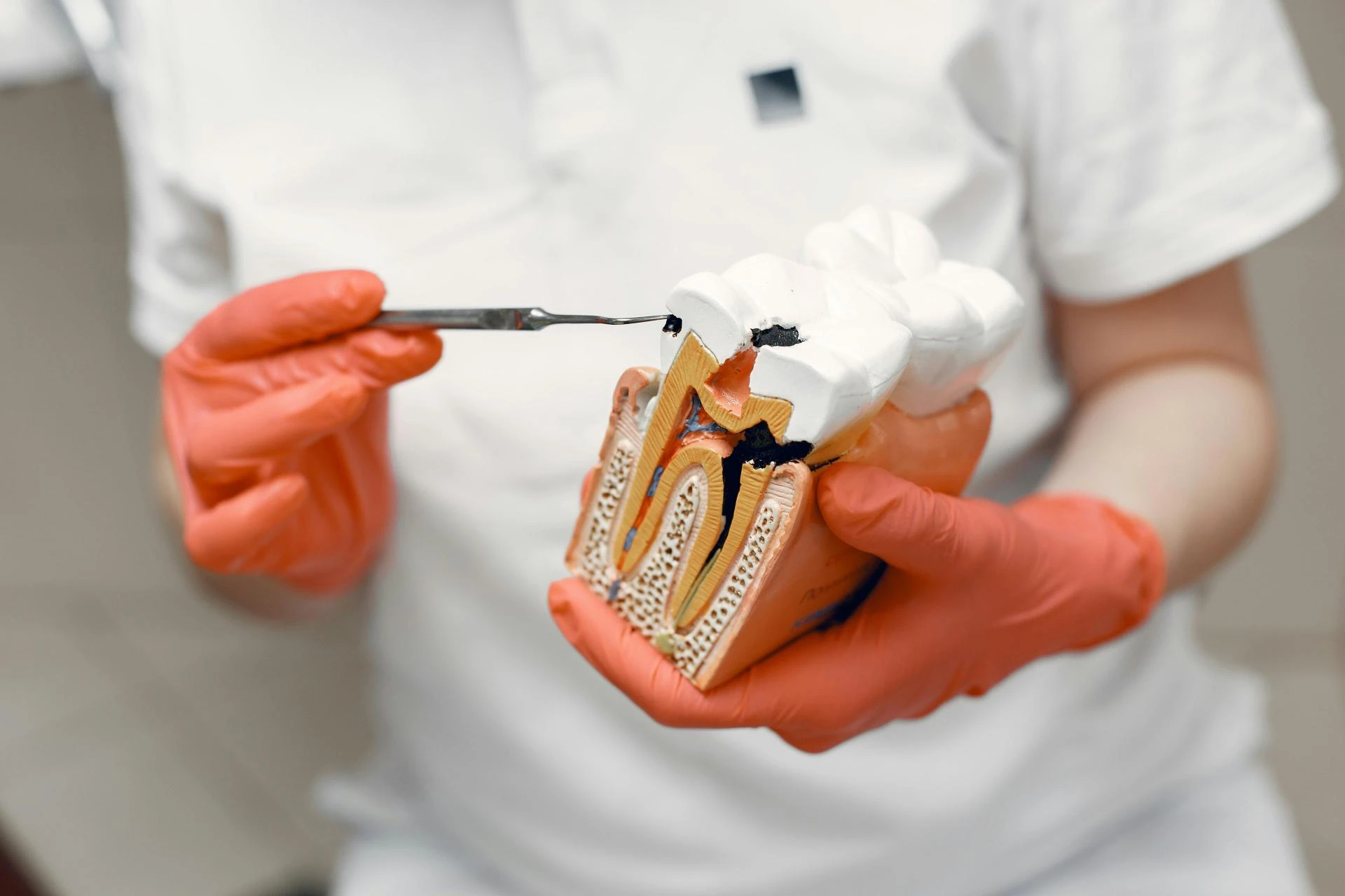 What to Eat After a Root Canal: Your Guide to a Comfortable Recovery