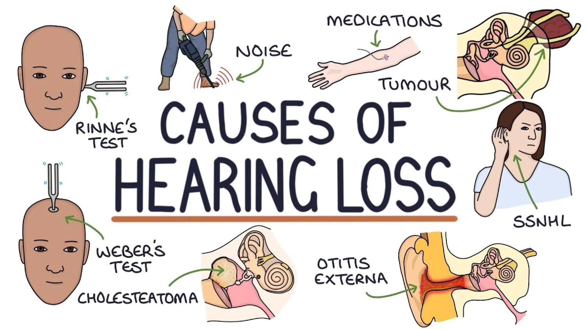 Why Do You Hear Ringing (Tinnitus)? Causes & What You Can Do