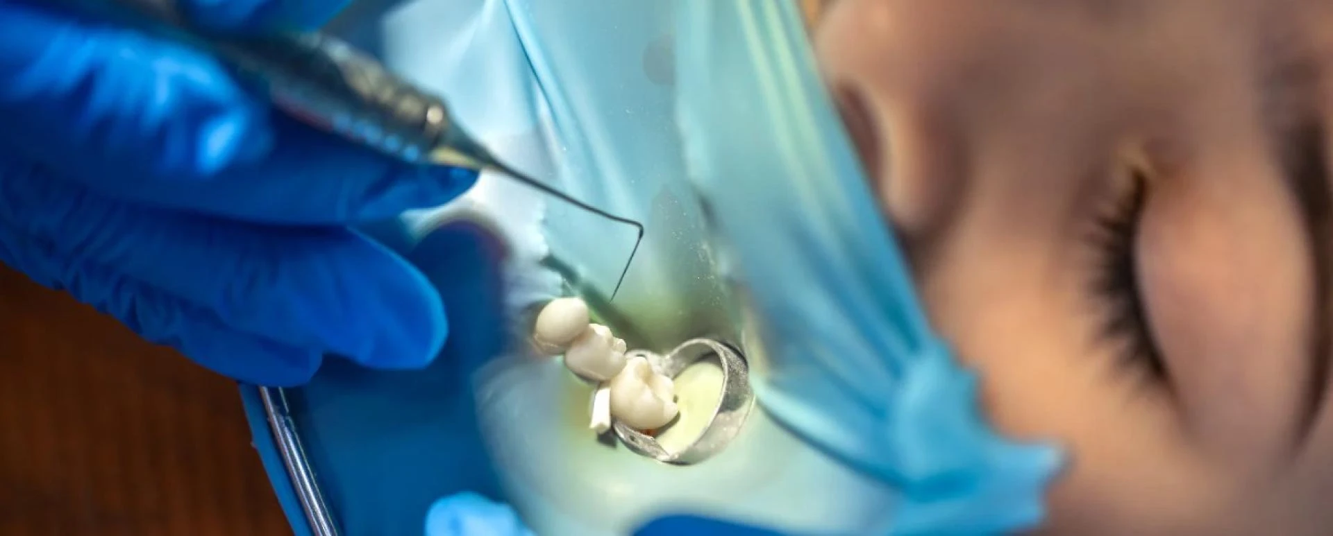 Dental Implants in Al Rigga