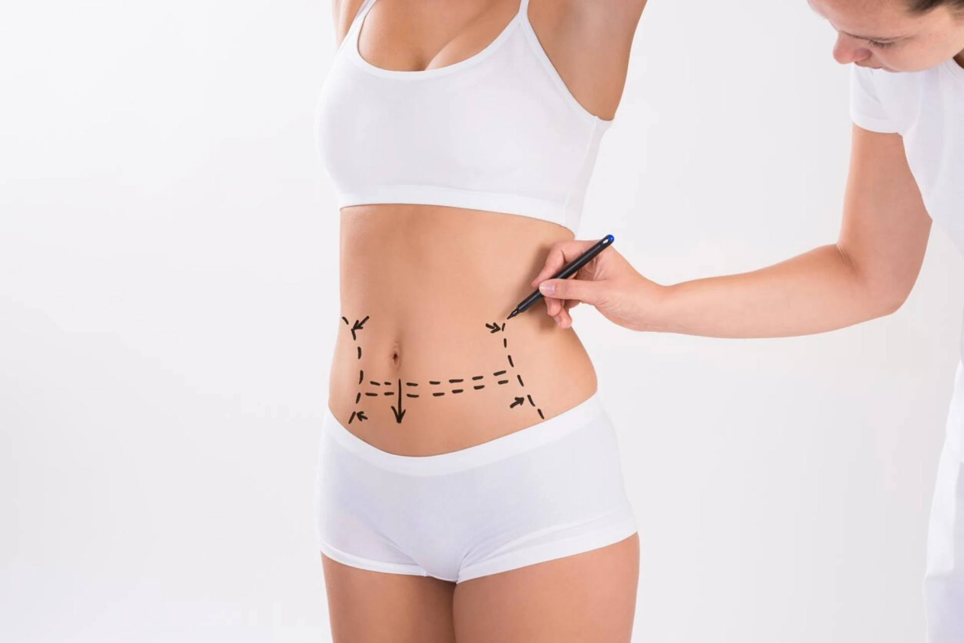 Liposuction in Dubai: Who Is the Ideal Candidate