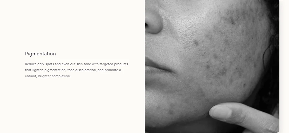Pigmentation | Best Skincare Brand in India