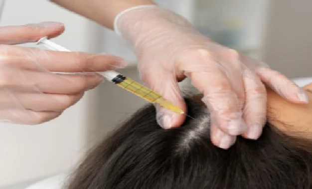 Hair Fall Treatment in Borivali East – Regain Your Confidence with Dr. Alok Mehta