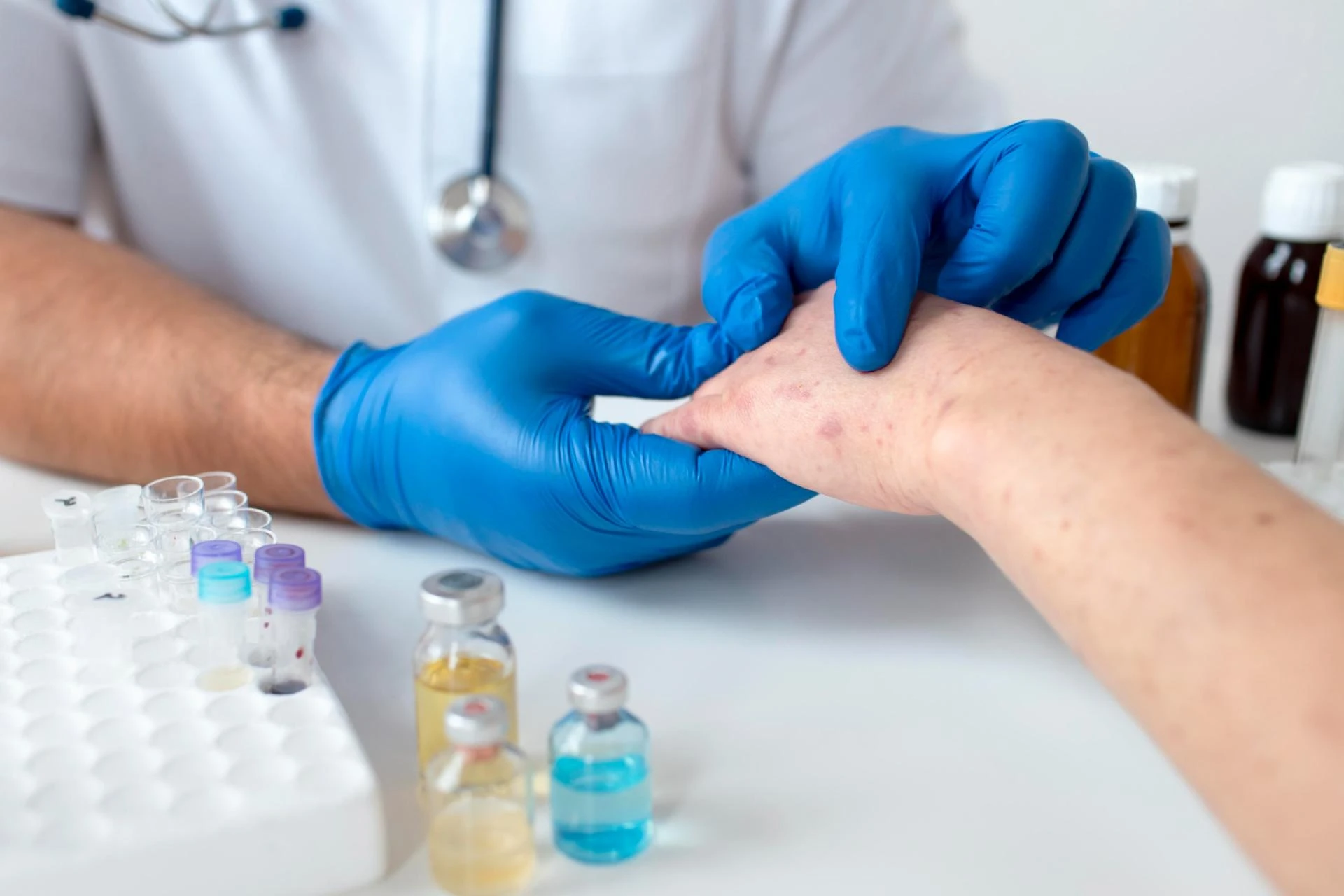How a Lyme Disease Clinic in London Can Help Diagnose and Treat Chronic Infections Effectively