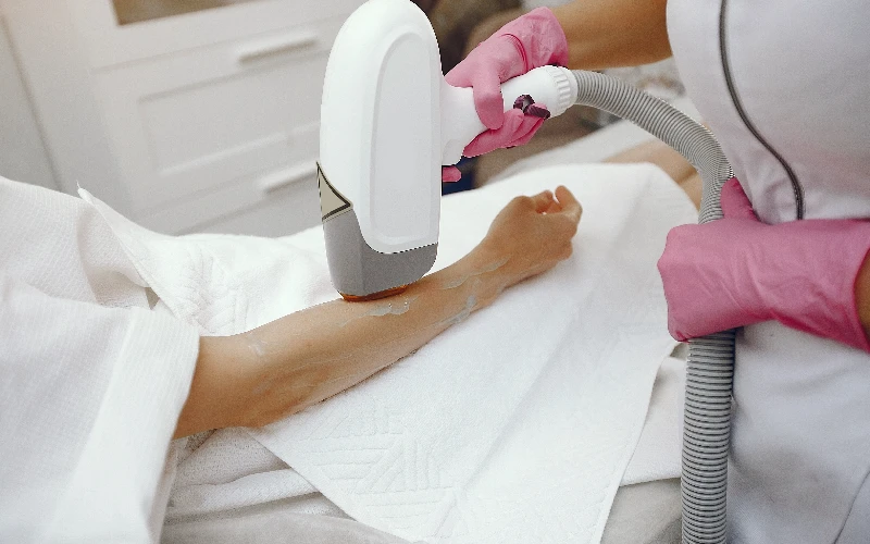 Laser Hair Removal Guide: Expert Insights & Top Tips