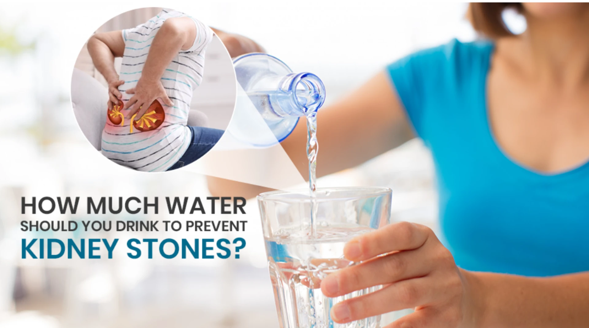 How much water should you drink to prevent kidney stones?