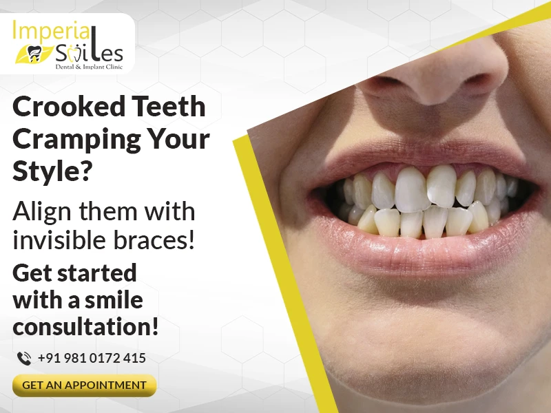Invisible Braces Cost in Gurgaon: What Affects the Pricing?