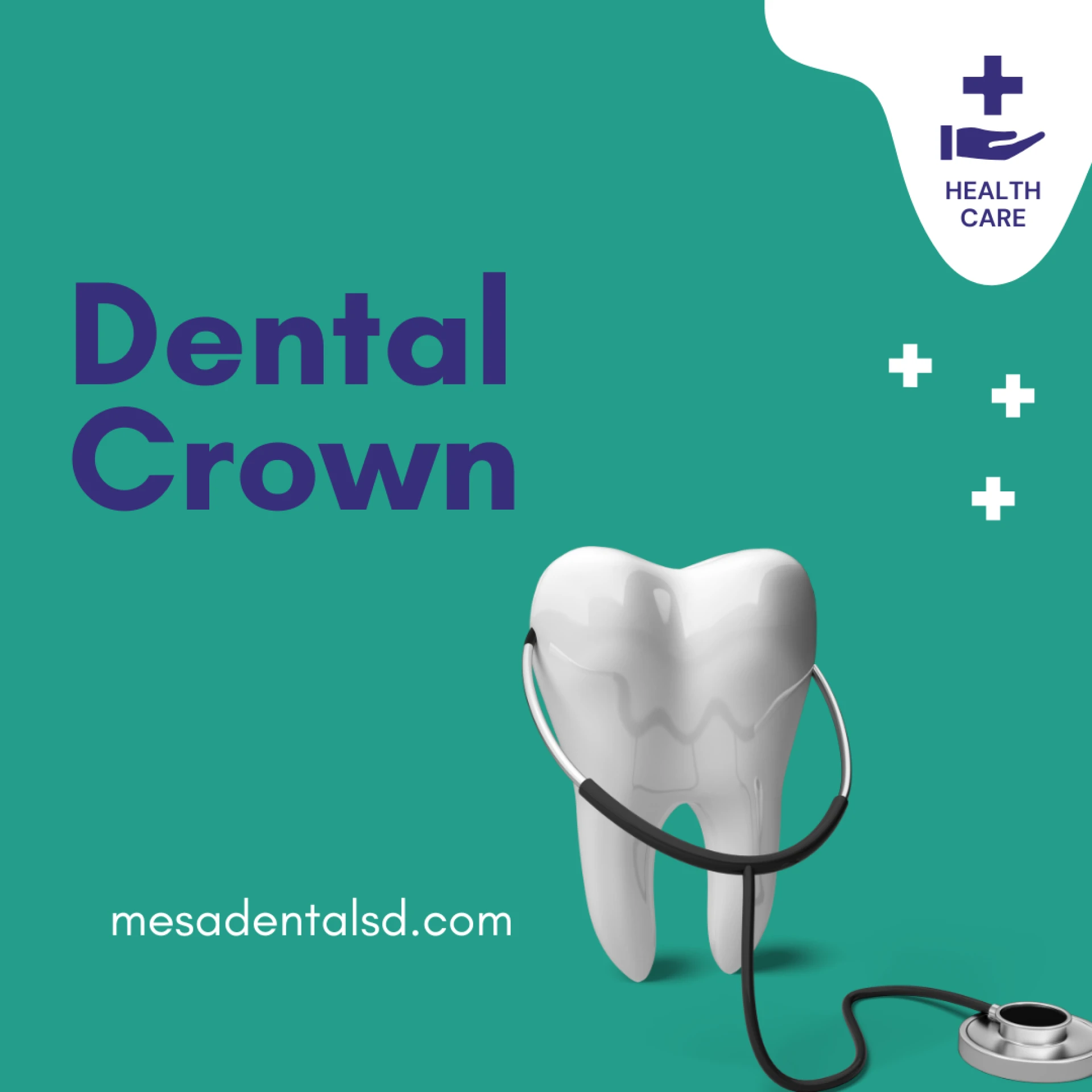 How Does the Dental Crown Procedure Work in San Diego?