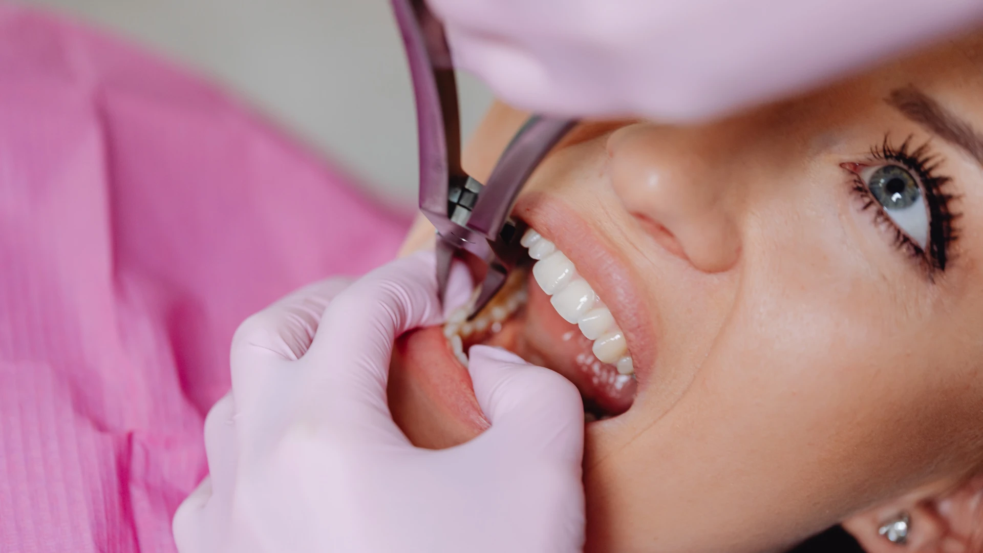 Phoenix Porcelain Veneers: Transform Your Smile with Natural, Long-Lasting Results
