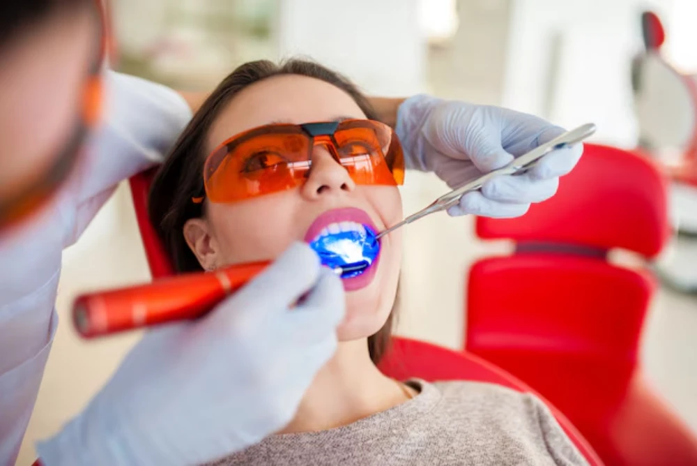 Top 5 Proven Benefits of Professional Teeth Whitening Treatments