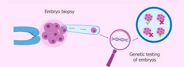 Preimplantation Genetic Testing (PGT): A Complete Guide for Couples Undergoing IVF