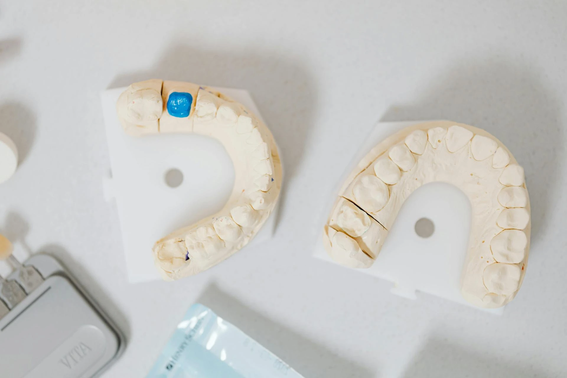 A Guide to Dental Crowns: Types, Costs, and Finding the Right Fit