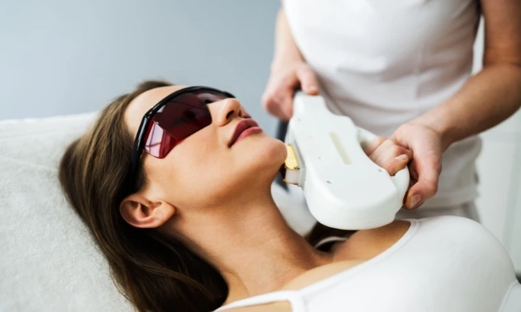 Why Choose IPL Photofacial in Arlington at Lumina Laser Beauty?