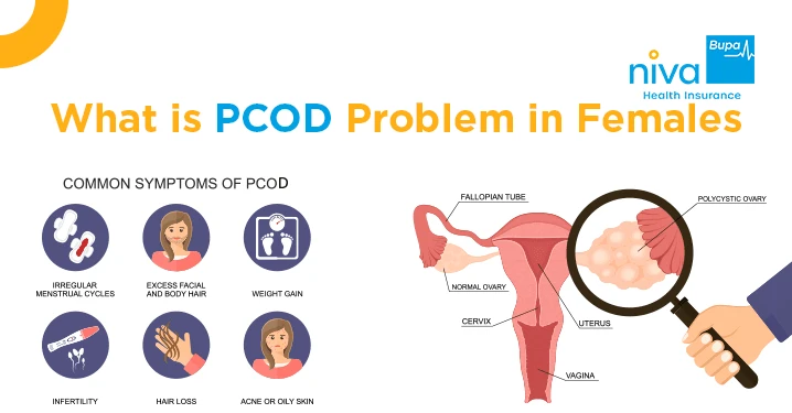 PCOD Full Form in Hindi: Meaning, Symptoms, and Treatment