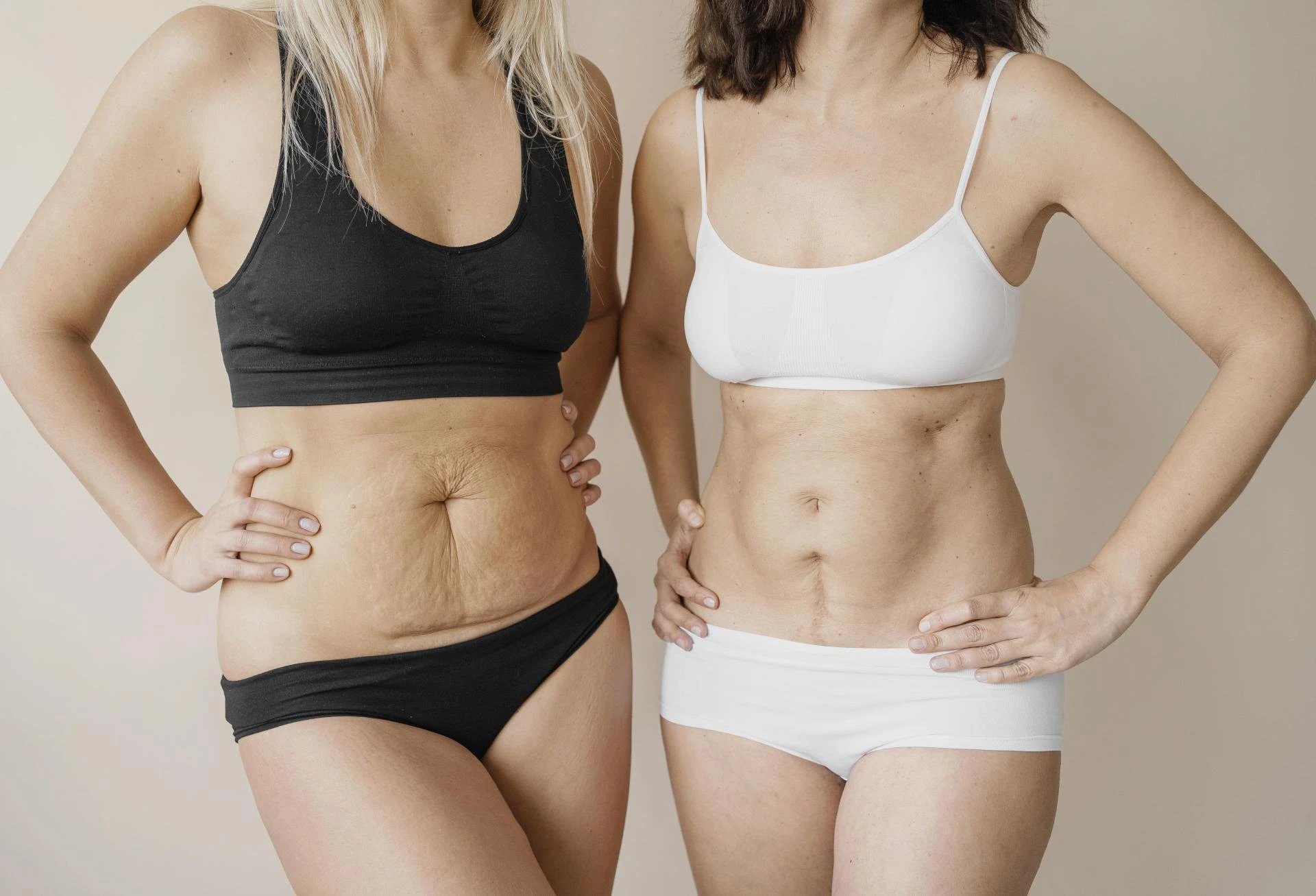 Why Post-Surgery Care Defines Your Mommy Makeover Results?