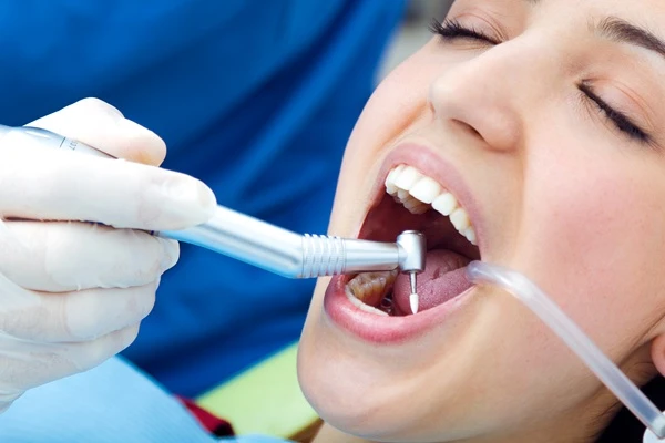 Dental Fillings for Sensitive Teeth: Why Early Treatment Matters