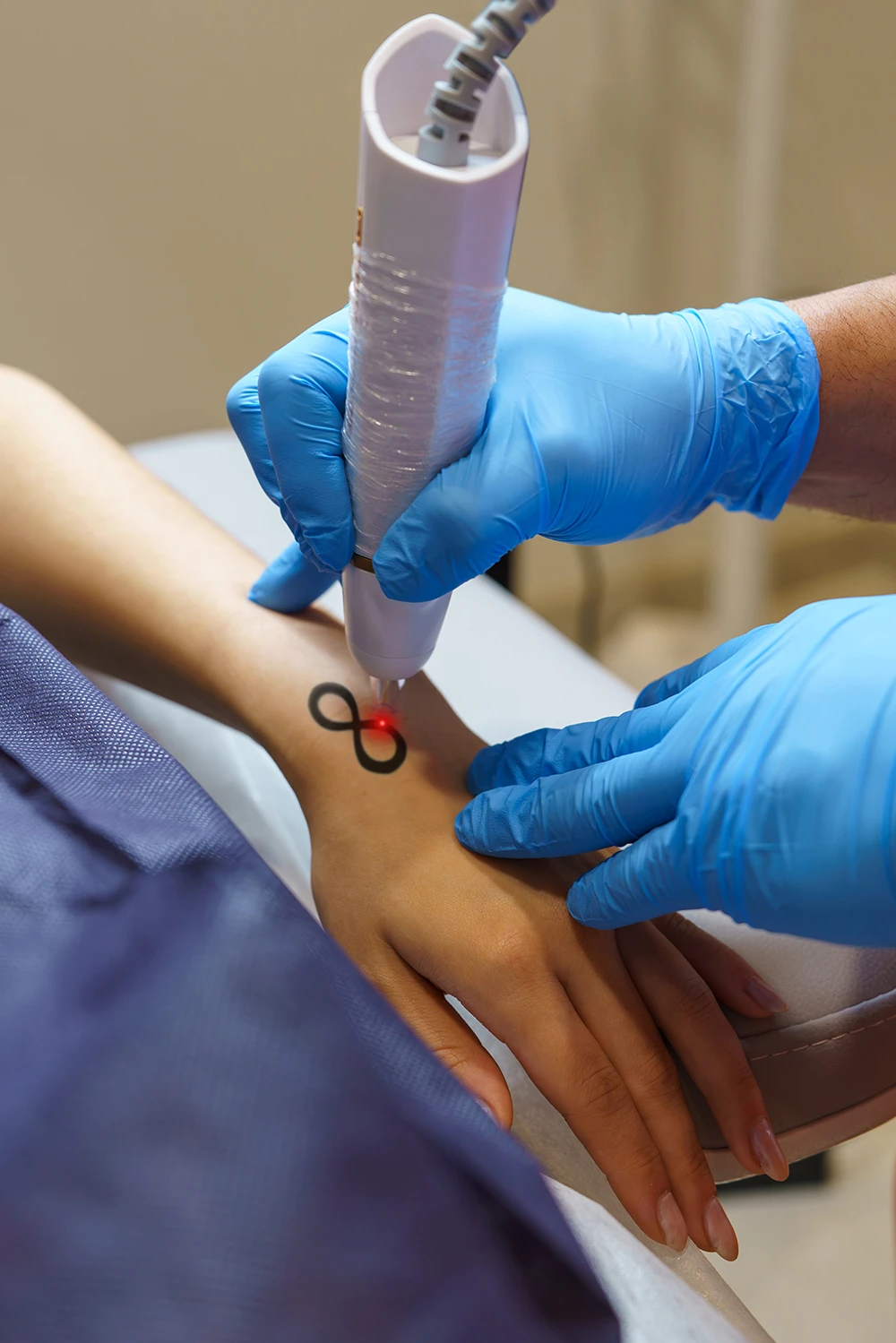 Who Should Consider Getting a Tattoo Removal?