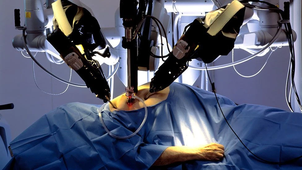Why Robotic Surgery is Becoming a Top Choice for Ventral Hernias