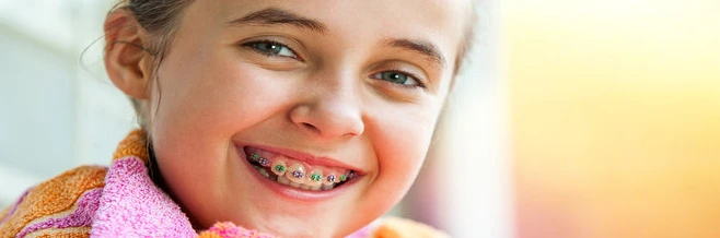 Why Braces Are Still a Proven Orthodontic Treatment?