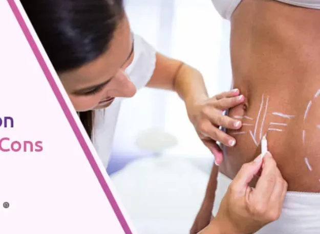 What Are the Benefits of a Tummy Tuck for Muscle Tone and Body Contour?