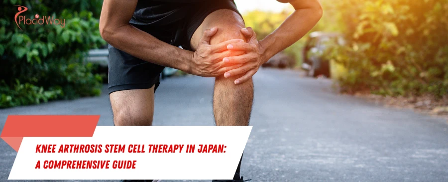 Knee Arthrosis Stem Cell Therapy in Japan: A Comprehensive Guide