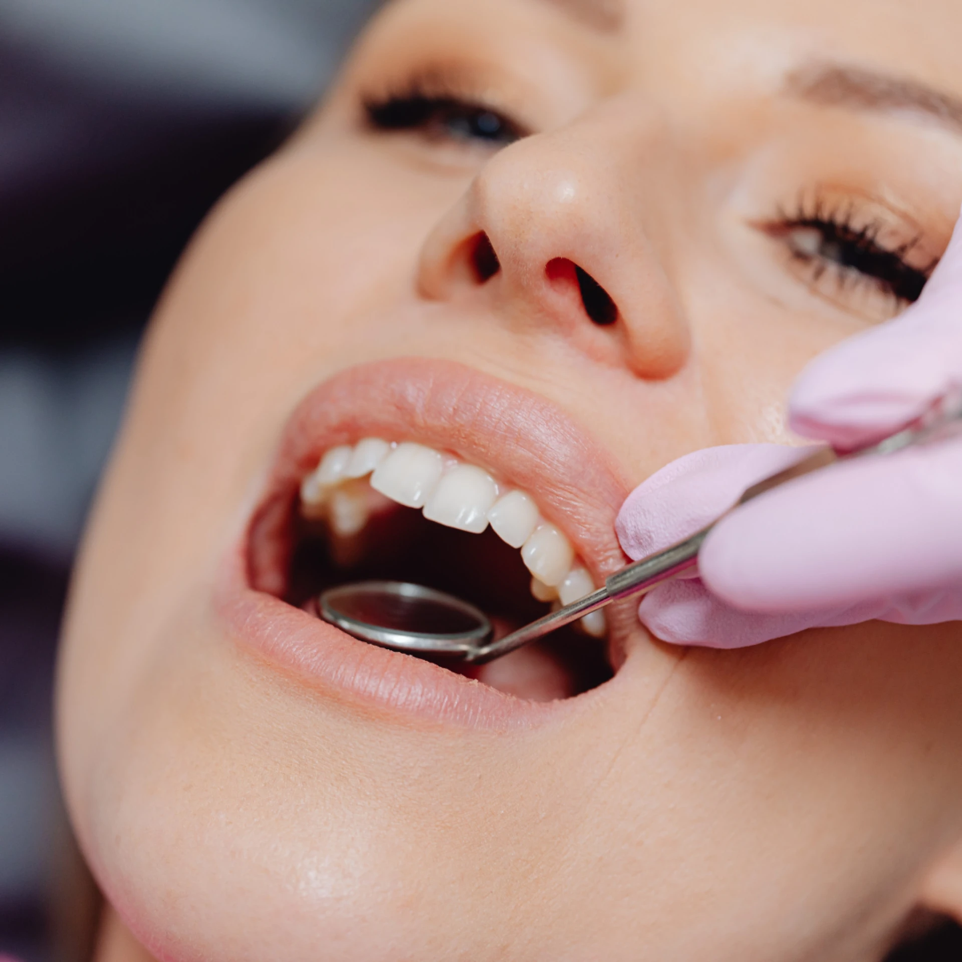 Full Mouth Reconstruction – Rebuild Your Smile and Confidence at Smile Fitness Dental Center