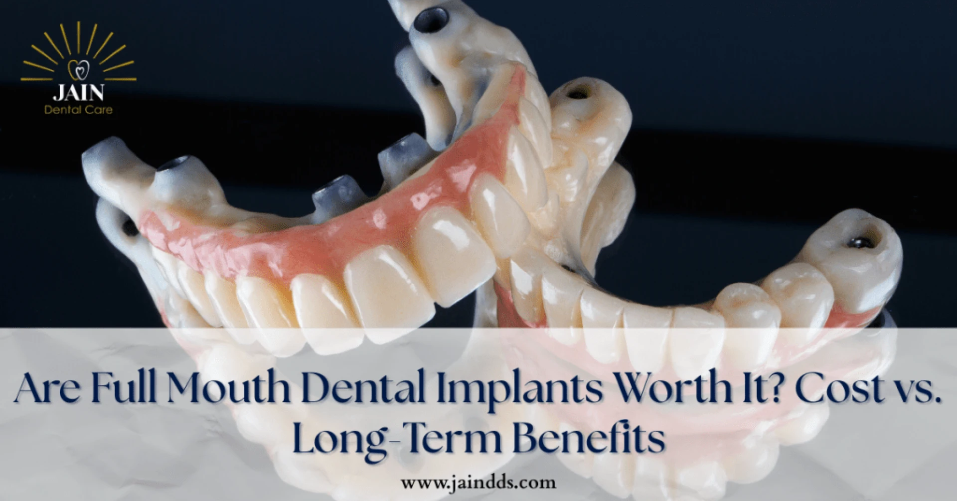 Full-Mouth Dental Implants: Why the Investment Often Pays Off