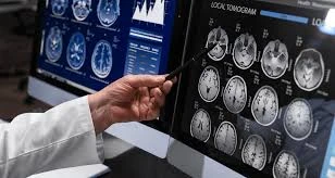 How Remote Neurological Care Is Reshaping Patient Access and Treatment