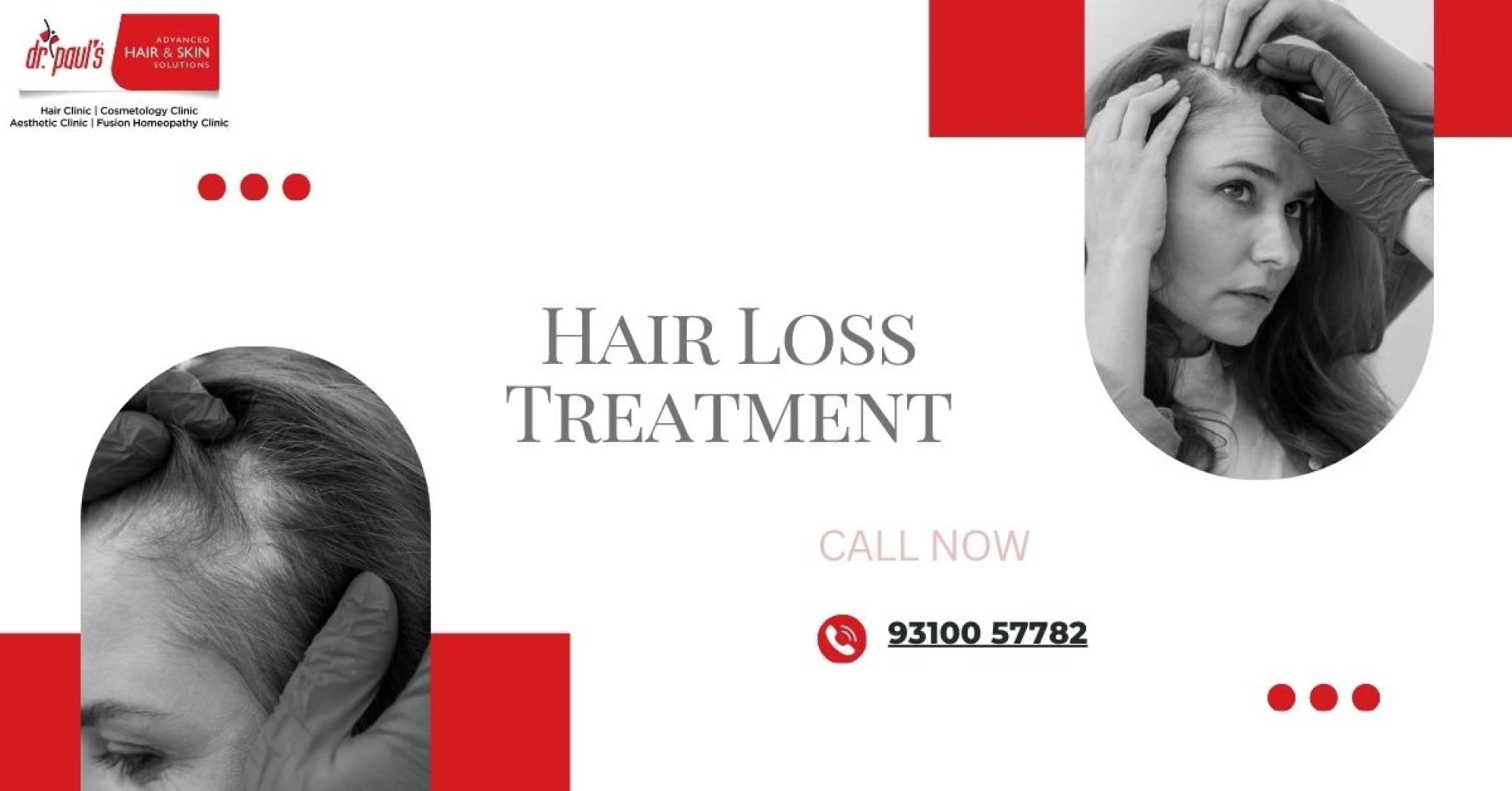 Finding the Best Hair Loss Treatment Near Me: Your Complete Guide to Regaining Confidence