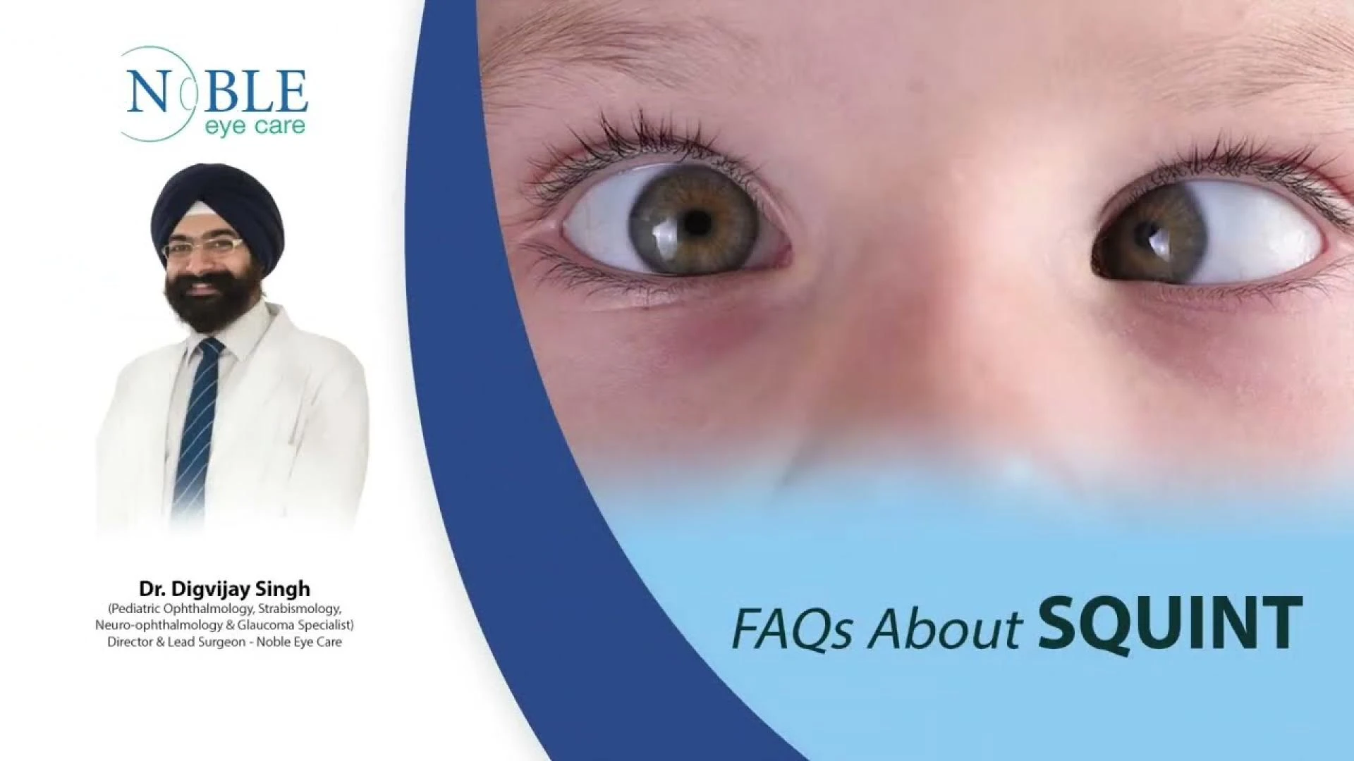 Understanding Squint: Causes, Symptoms, and Treatments Explained