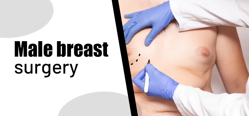 Types of Male Breast Surgery