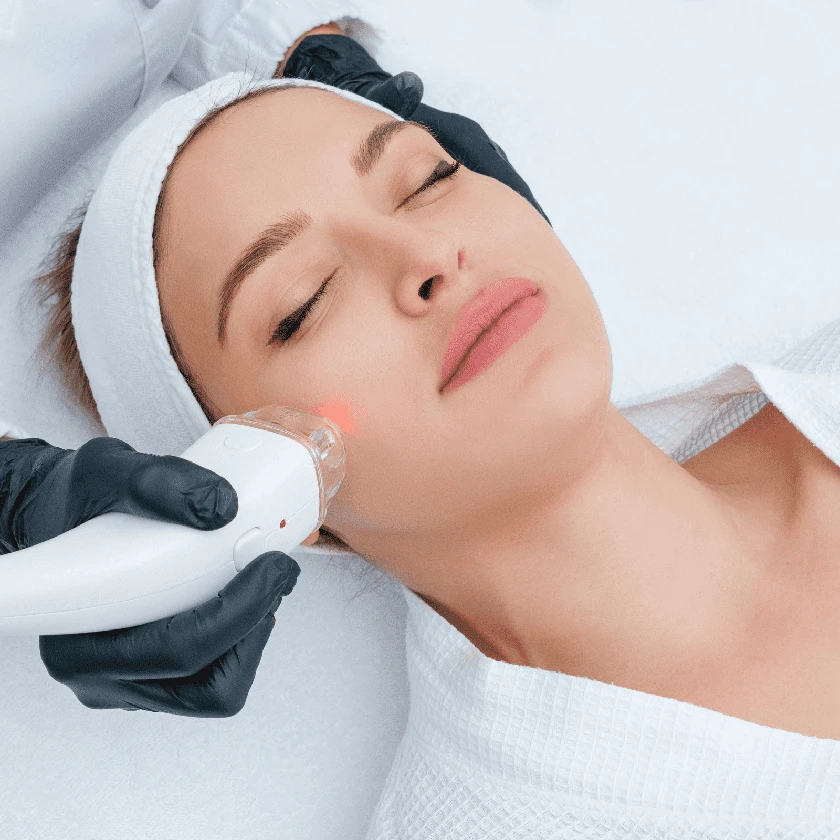 How to Treat Acne Naturally and Medically – Complete Guide
