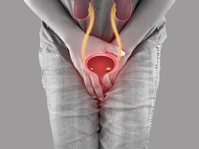 Types of Incontinence & Treatment Options