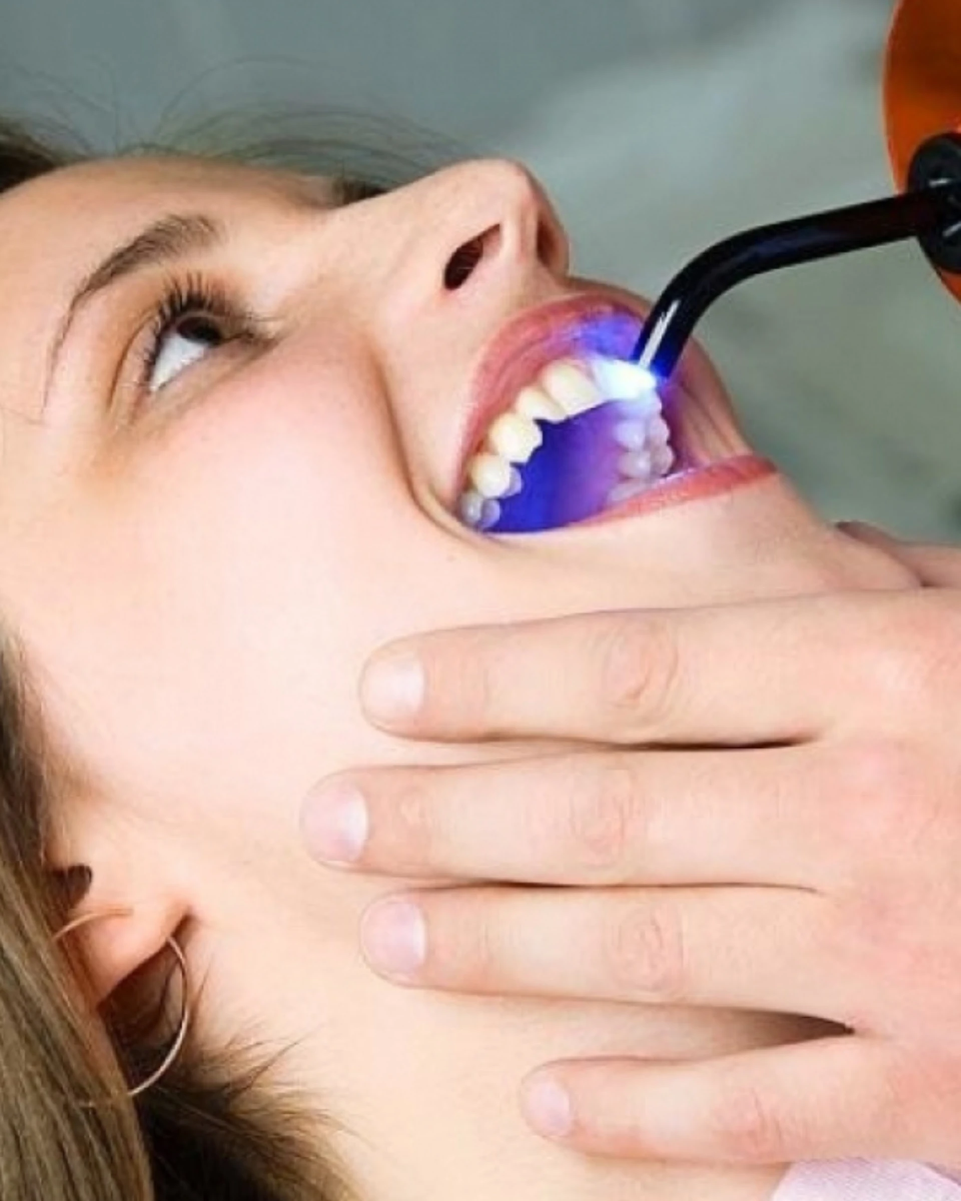 IV Sedation Dentistry for Comfortable Dental Visits