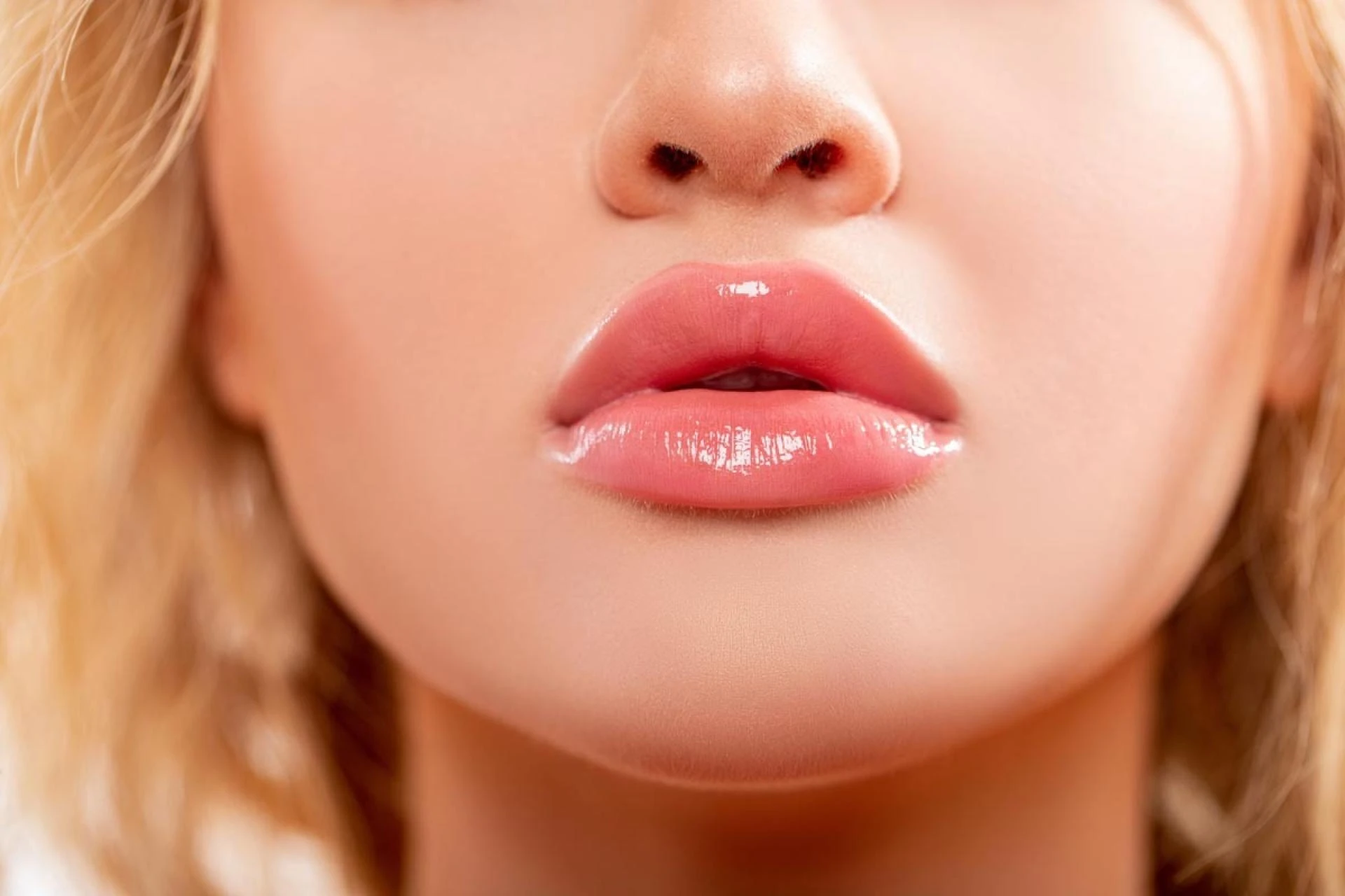 Why Are Lip Fillers Toronto So Popular for Subtle and Balanced Results