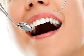 Your Perfect Smile Is Closer Than You Think: Trusted Dental Care Around Kundalahalli