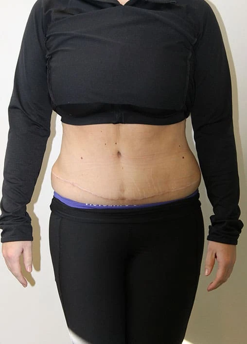 Lower Belly Transformation Made Simple