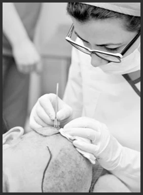How Does Sapphire Technology Improve Hair Transplant Outcomes?