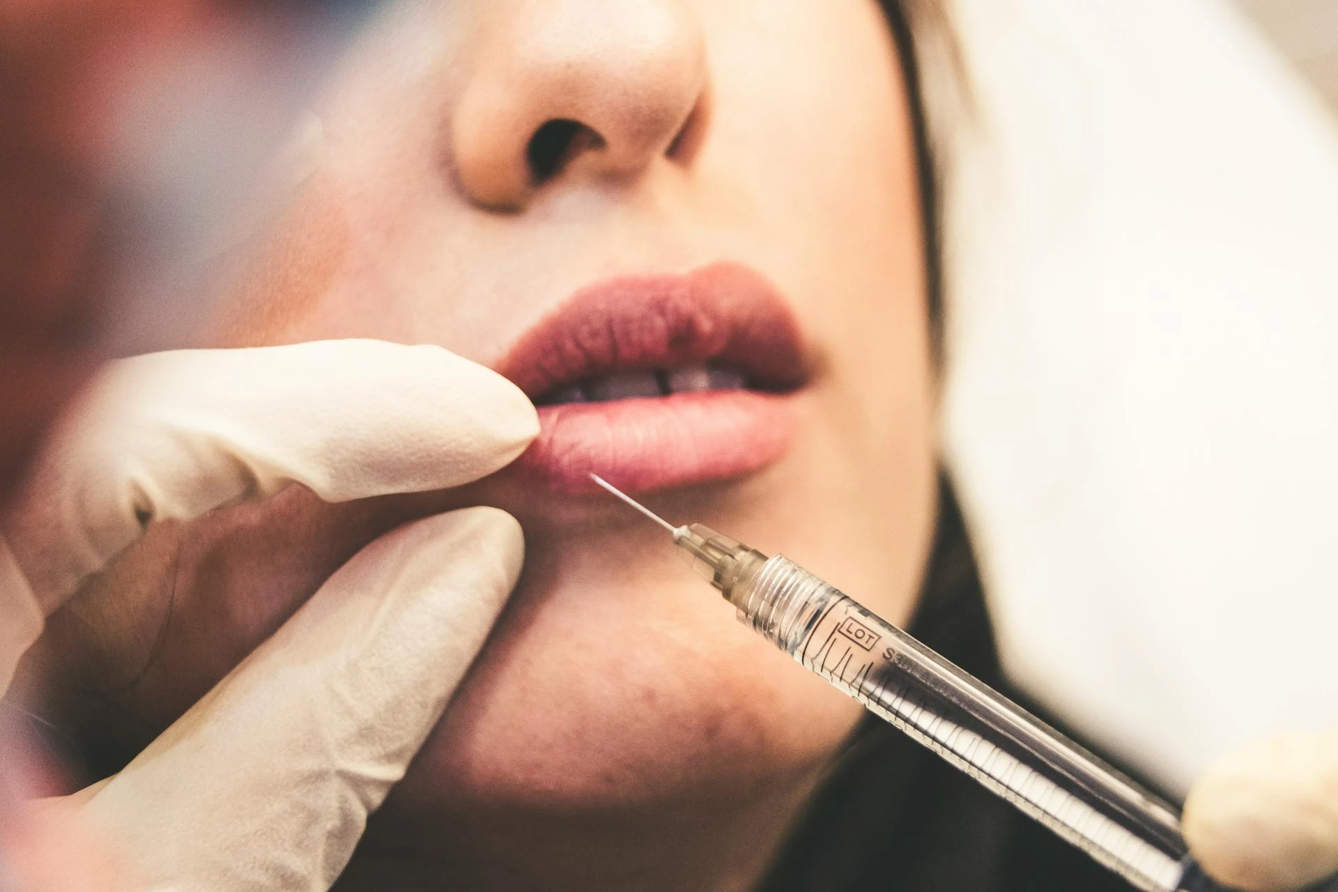 Lip Filler Experience at Manchester Aesthetics Clinic