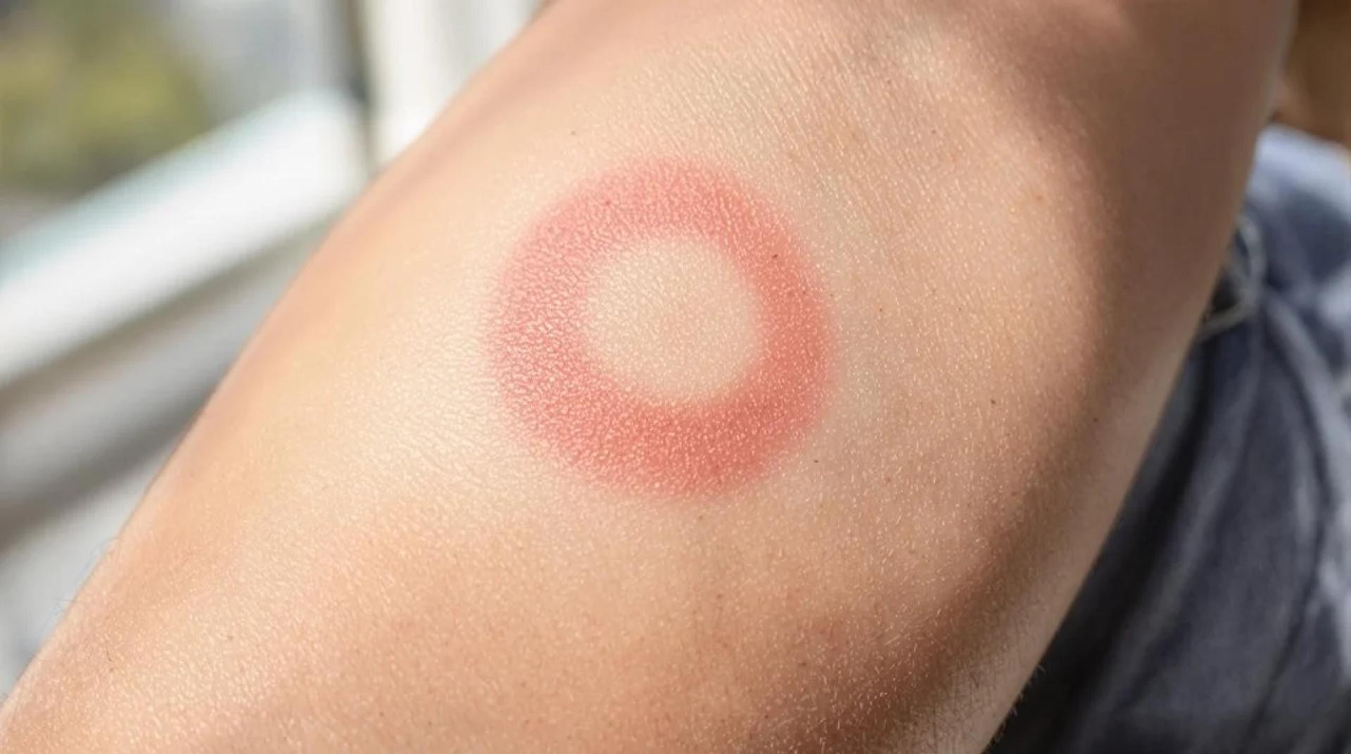 Accessing Prescription Weight Loss Medications Outside the U.S.: What Patients Should Consider