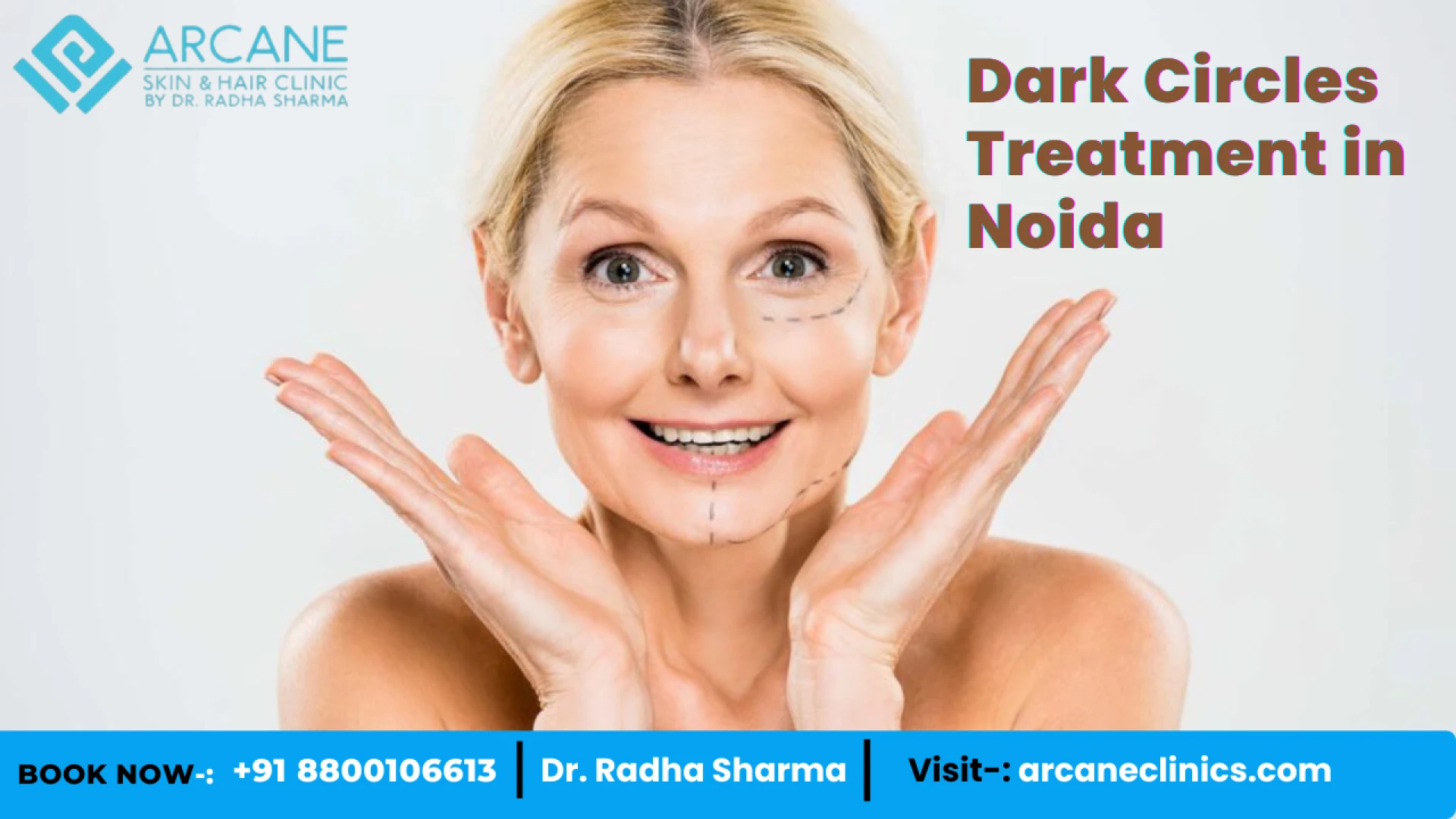 Best Dark Circle Removal Methods Recommended by Dermatologists
