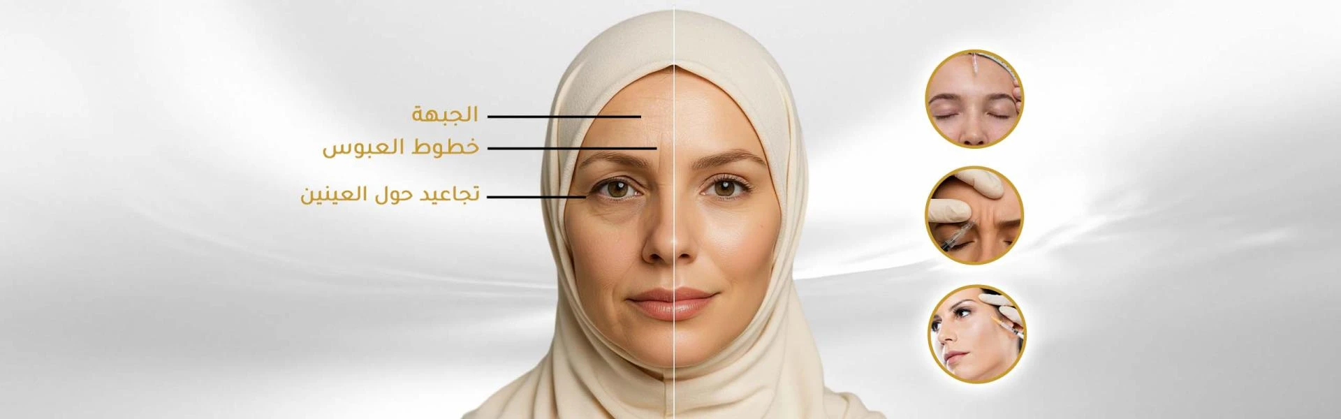 بوتوكس ديسبورت في عيادات التجميل بدبي جميرا: سر الشباب الدائم لبشرتك