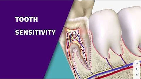 Why Teeth Feel More Sensitive During Winter Months