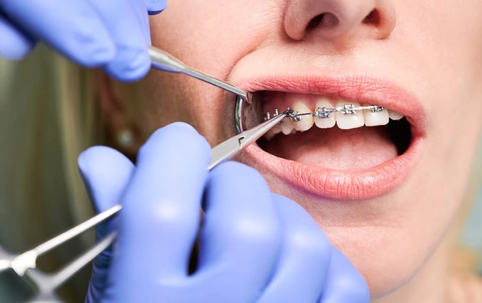 Orthodontic Clinic in Abu Dhabi
