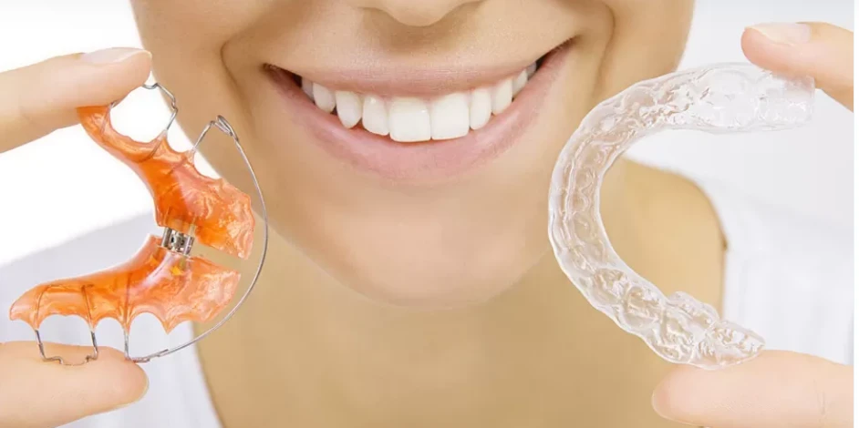 The Significance of Retainers in Abu Dhabi for Preserving Your Smile