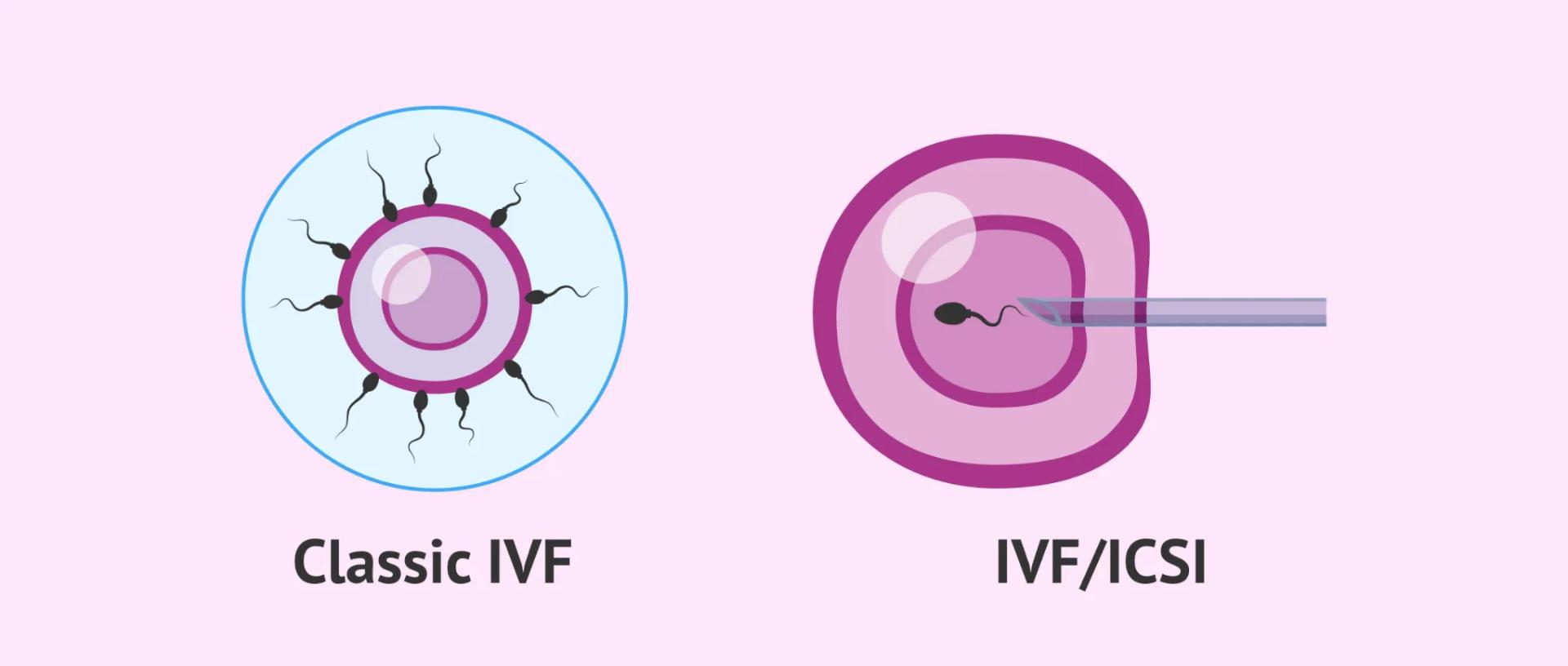 Fertility Treatments in Hyderabad
