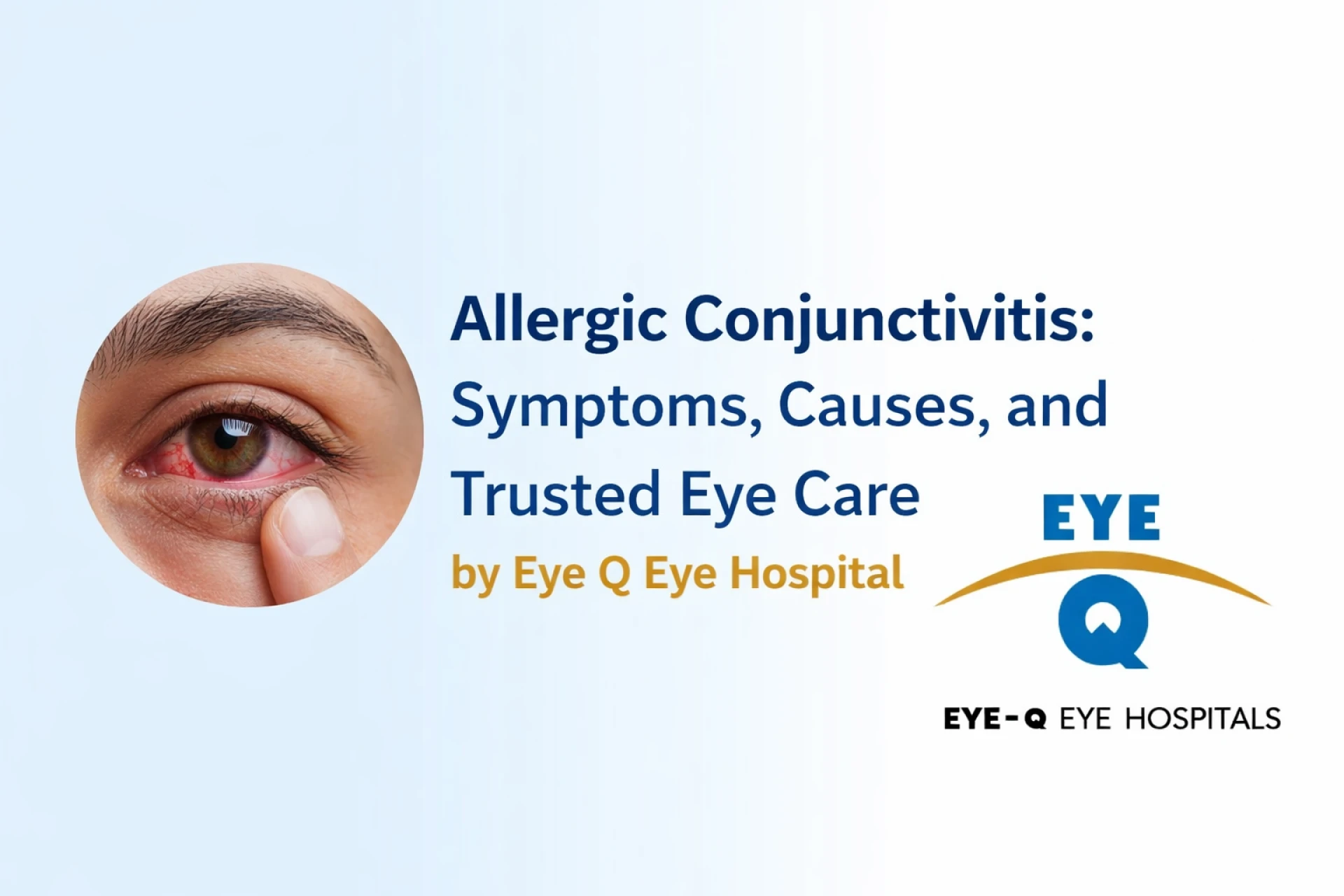 Allergic Conjunctivitis: Symptoms, Causes, and Trusted Eye Care by Eye Q Eye Hospital