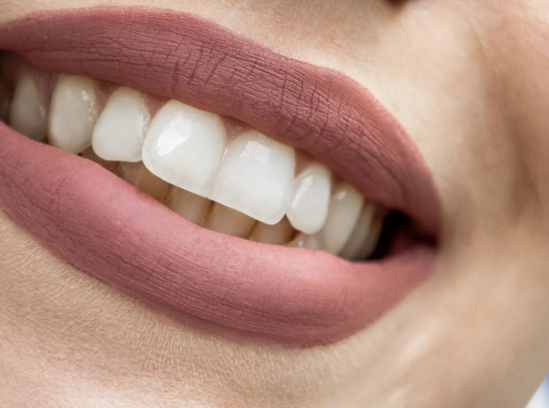 Restoring Your Smile: How Many Dental Implants Are Really Needed for a Full Mouth?