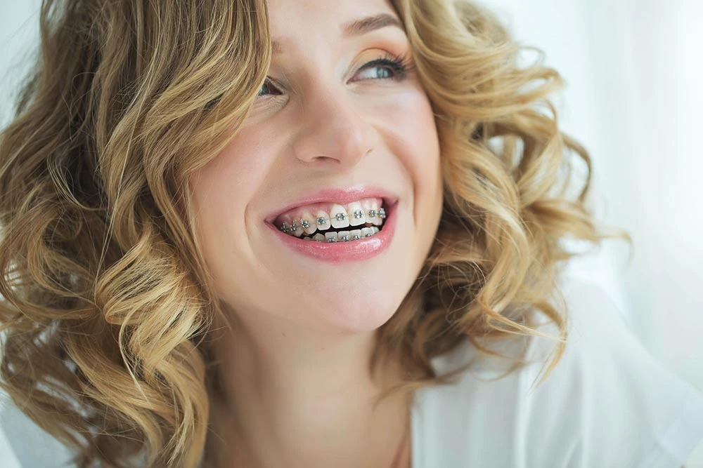 Who Can Benefit Most from Braces Orthodontics Treatment?