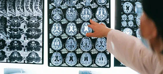 Are You Exploring PEMF Therapy Options in Maryland?