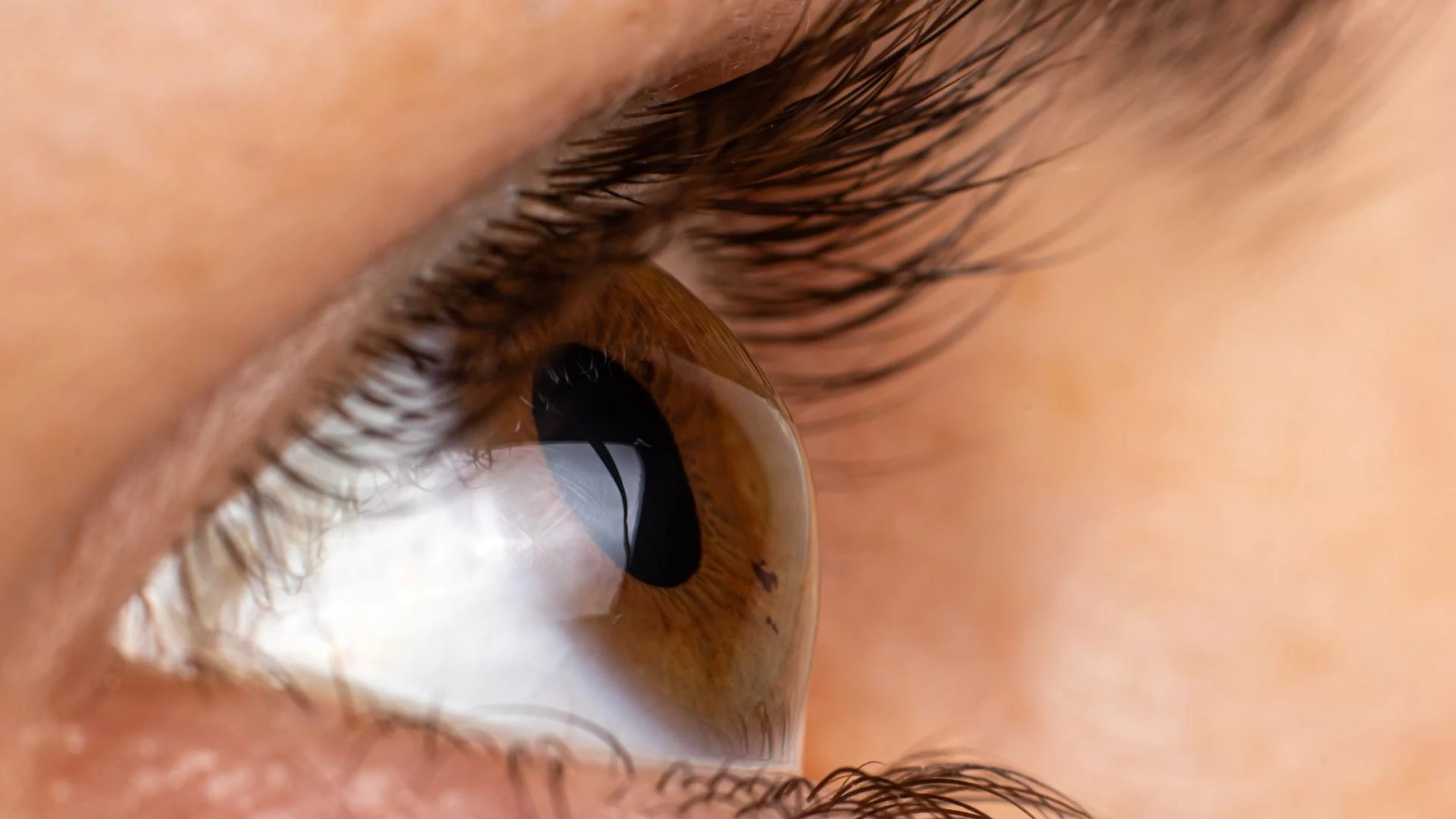 Seeing Through a New Lens: How Cornea Treatment in Chembur Restores Vision and Confidence